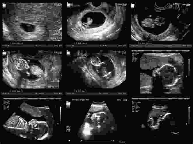 Fetal Development And Ultrasound Pregnancy Week By Week : Pregnancy Guide: Voices From The Womb