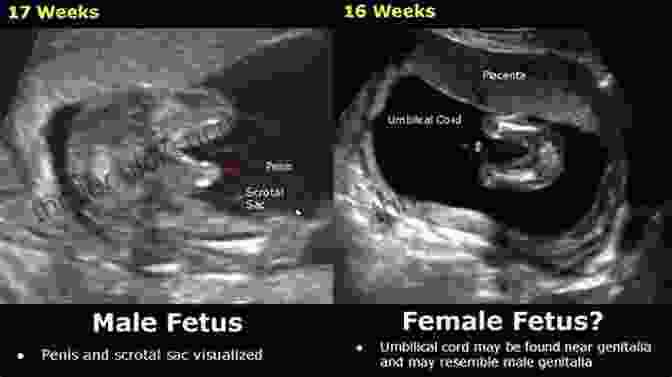Fetal Movement And Gender Determination Pregnancy Week By Week : Pregnancy Guide: Voices From The Womb