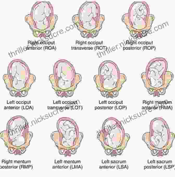 Fetal Positioning And Lanugo Pregnancy Week By Week : Pregnancy Guide: Voices From The Womb
